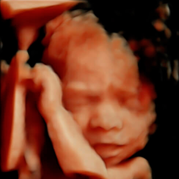 25 semanas de embarazo