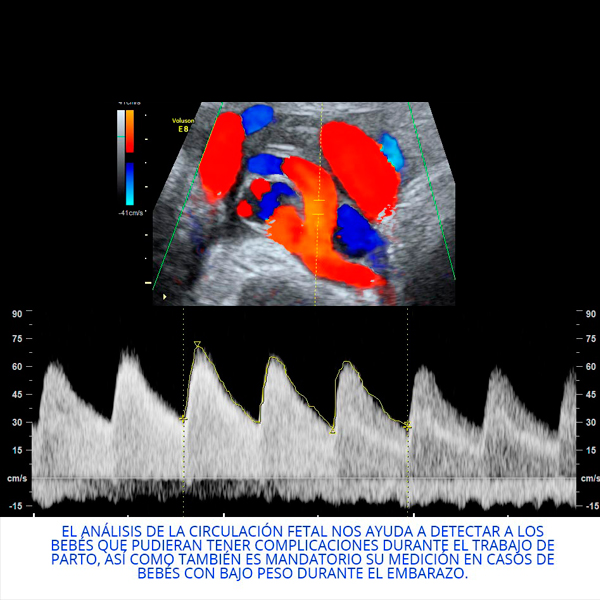 Doppler fetal